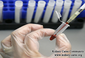 Are There Remedies To Lower High Creatinine Level Rather Than Dialysis
