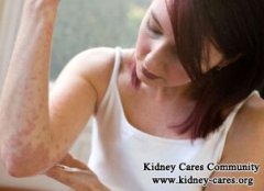 How to Cure Skin Rash in A Person with Kidney Disease