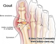 Can Gout Lead To Uremia
