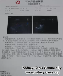 Is PKD A Disease That Can Be Cured From The Root