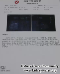 Is PKD A Disease That Can Be Cured From The Root
