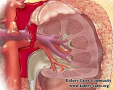 Does Kidney Cyst Less Than 3 cm Require No Treatment