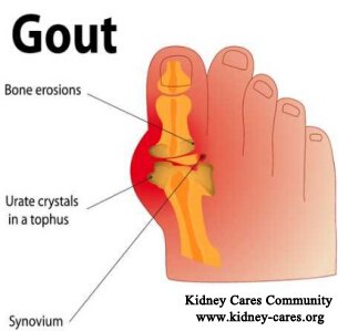 Is Gout Associated with Dialysis