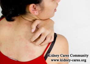 How Could CKD Patients Recover from Excessive Itching Without Medicine