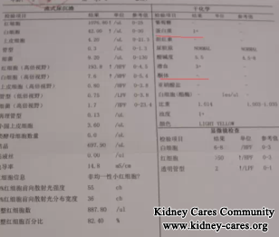 How To Treat A Baby With Acute glomerulonephritis