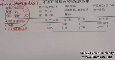  Treatment For Primary Nephrotic Syndrome In Specialized Kidney Disease Hospital