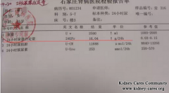  Treatment For Primary Nephrotic Syndrome In Specialized Kidney Disease Hospital