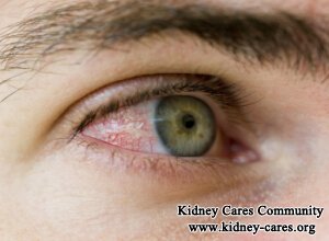 Can Kidney Disease Cause Red Eyes