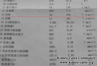 Correct Treatment For Systemic Lupus Erythematosus