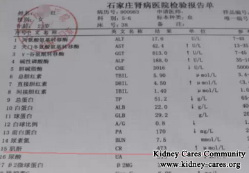 Correct Treatment For Systemic Lupus Erythematosus