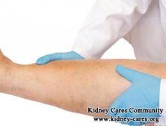 How to Control Leg Swelling in Someone with Polycystic Kidney Disease