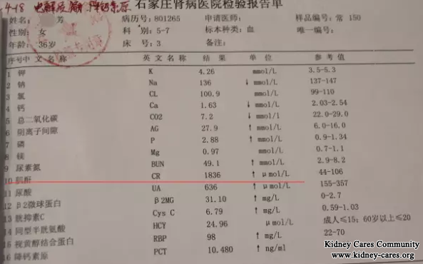 Formal Treatment For Systemic Lupus Erythematosus