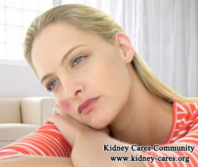 What Are Treatment Options When Lupus Attacks Kidneys