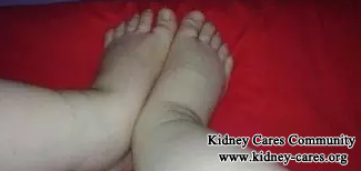 It Is Possible For Nephrotic Syndrome Patients To Avoid Renal Biopsy