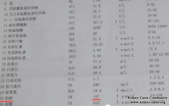 High Creatinine Level Is Reduced To The Normal Range