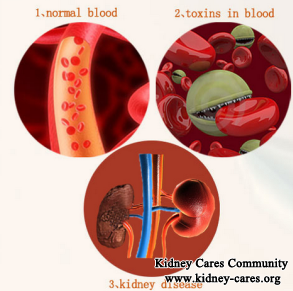 Blood Cleaning&Detoxification Therapy Can Treat Chronic Kidney Disease