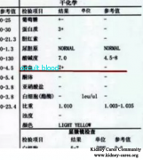 Recovery From Lupus Nephritis And Occult Blood 2+ Become -