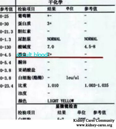 Recovery From Lupus Nephritis And Occult Blood 2+ Become -