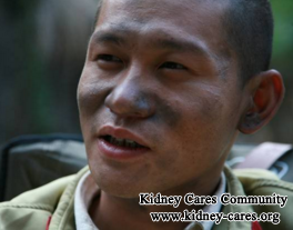 Diabetic Nephropathy Can Cause Black Face 