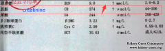 Interstitial Nephropathy Causes High Creatinine Level and Joint Pain