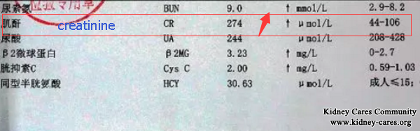 Interstitial Nephropathy Causes High Creatinine Level and Joint Pain