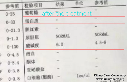 Shijiazhuang Kidney Disease Hospital Treats My Purpura Nephritis With No Relapse