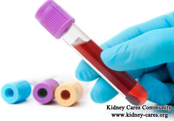 Creatinine Level 11 Too High: How To Lower It