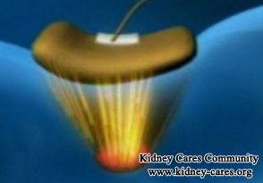 Can I Get Micro-Chinese Medicine Osmotherapy for PKD In USA