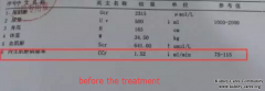 Chinese Medicine Treatment Decrease High Creatinine and Increase Urine Volume