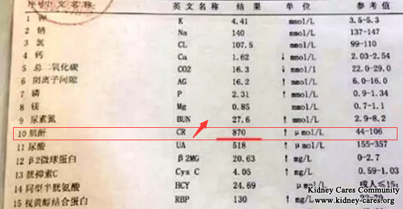 Is Dialysis The Only Option For My Creatinine Level 870umol/L