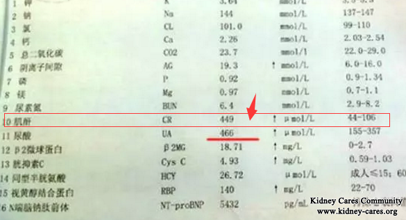 Is Dialysis The Only Option For My Creatinine Level 870umol/L