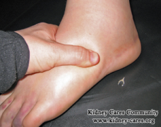No Dialysis, Swelling Feet, What Can Be Done