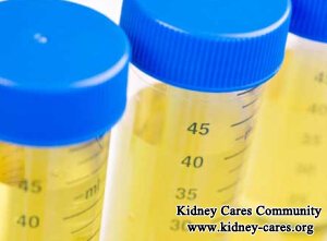 Will Dialysis Cut Down Daily Urine Output