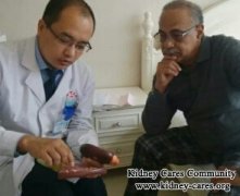 Will Blood Creatinine Level Increase Because of Cyst