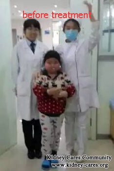 Look At This Big Face and Nephrotic Syndrome Boy