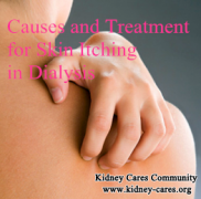 Skin Itching in Dialysis Patients: What Should You Do