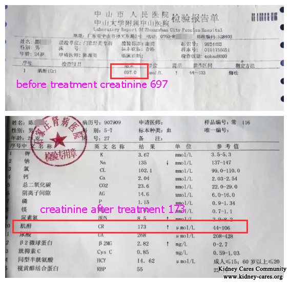 IgA Nephropathy: Serum Creatinine Level Reduced From 697 to 173 With Chinese Treatment
