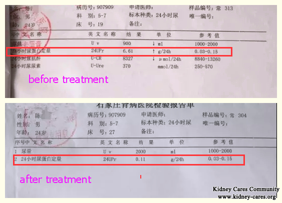 IgA Nephropathy: Serum Creatinine Level Reduced From 697 to 173 With Chinese Treatment