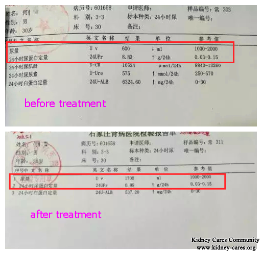 Great Curative Effects: His Swelling is Controlled Well After Taking Chinese Treatment