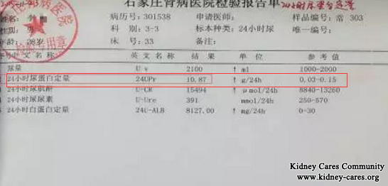 Proteinuria 10.87g In Nephrotic Syndrome Is Reduced To 0.3g