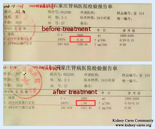 Do You Still Think That Only Steroid Can Treat Kidney Disease