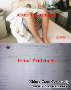 Toxin-Removing Treatment For Purpura Nephritis In Shijiazhuang Kidney Disease Hospital