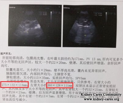 PKD: After 21 Days’ Treatment, Kidney Cysts Shrink Naturally