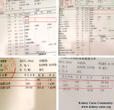 Protein 3+ Become - and 24UPr Become 0.13g from 3.05g In Nephrotic Syndrome