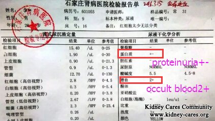 Purpura Nephritis: Proteinuria+- and Occult Blood 2+ Turned Negative Without Steroids