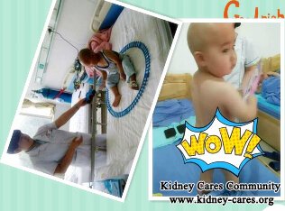 Toxin-Removing Treatment Control Purpura Nephritis Radically