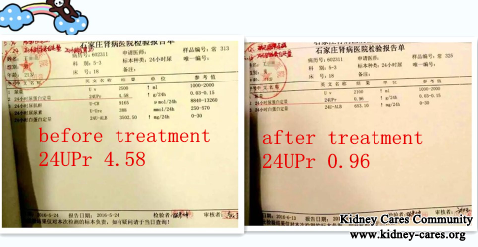 A Red Letter Day For This Nephrotic Syndrome Patient