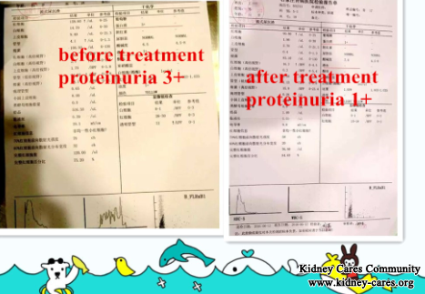 A Red Letter Day For This Nephrotic Syndrome Patient