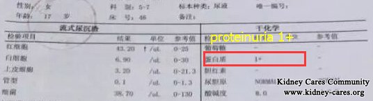 How to Lessen Protein in Urine for Membranous Nephropathy Patients