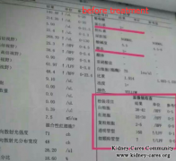 Toxin-Removing Treatment Treats Lupus Nephritis Effectively